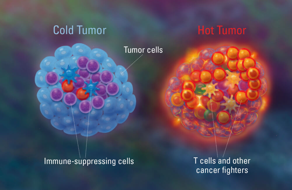 tumors alternative treatment